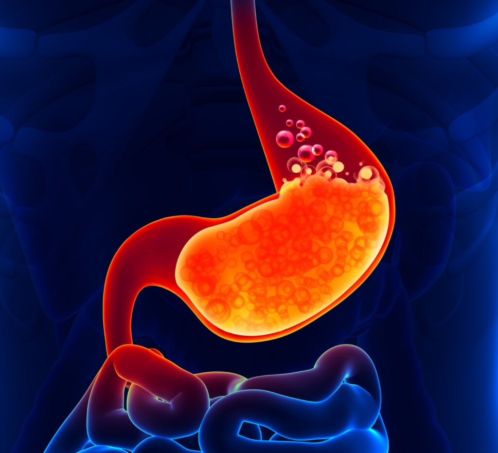 steps to naturally improve stomach acid levels